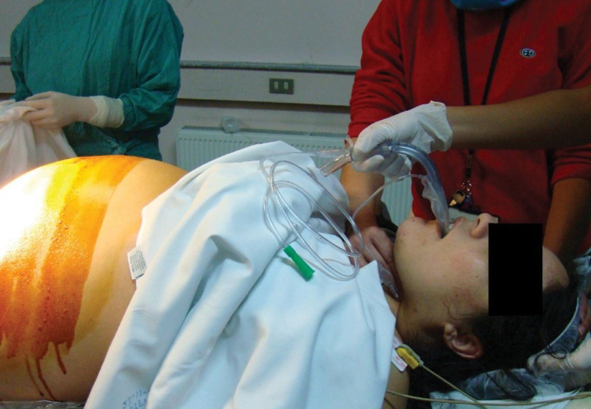 Obstetricia